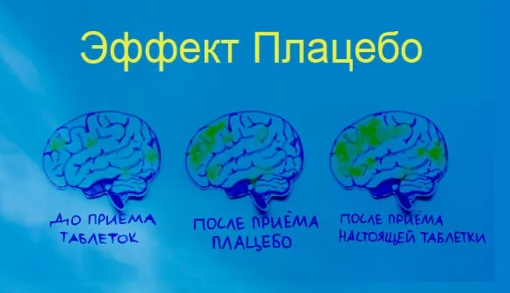 Эффект плацебо: лечение без лечения?